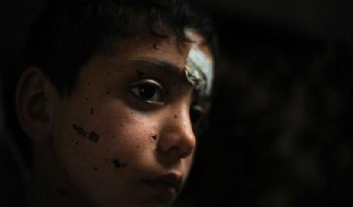 0083CE-NEWS_62395 In Siria torture atroci sui bambini