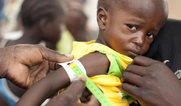Unicef: 200 milioni di bimbi malnutriti
