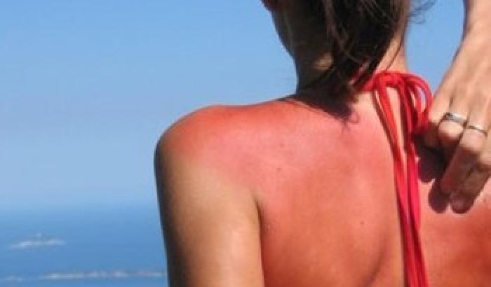 00B343-NEWS_88491 Come prevenire le scottature al mare