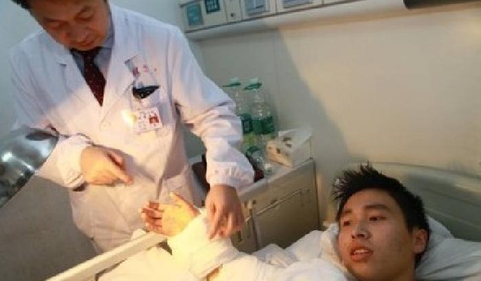 Cina: medici attaccano la mano alla gamba per tenerla in vita