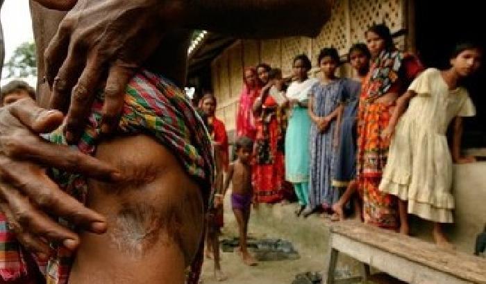 India: 84enne muore in ospedale dopo una violenza sessuale