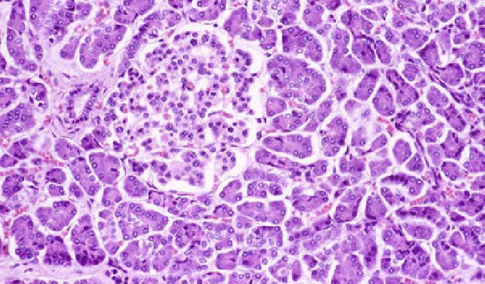 Batteri nella saliva per predire il tumore al pancreas