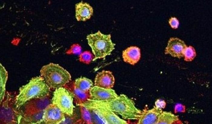 Scoperto lo starter delle cellule tumorali