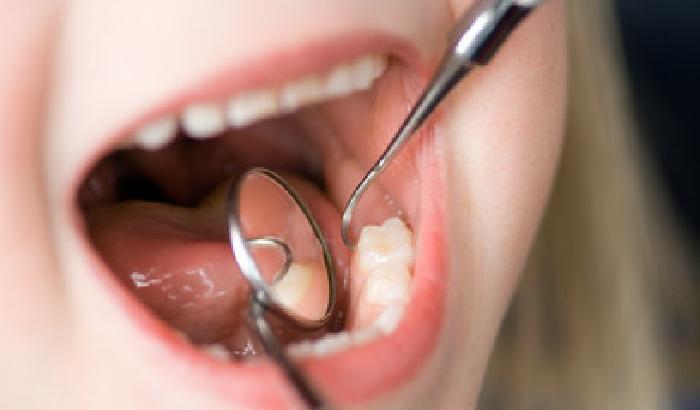 Carie dentali: adesso si curano con una scossa elettrica