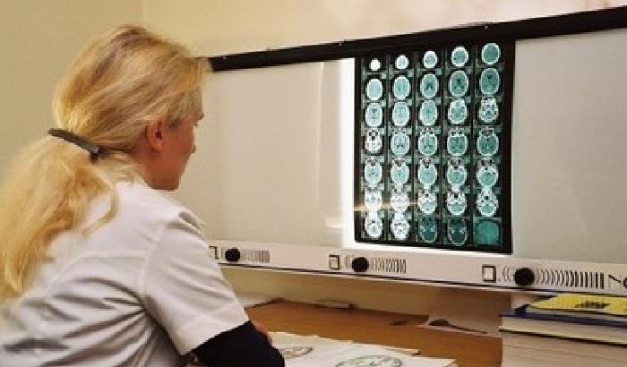Alzheimer: la ricerca italiana fa passi in avanti