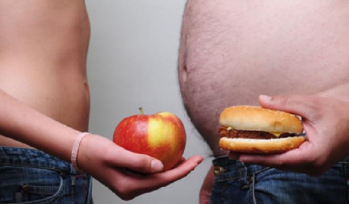 L'obesità diminuisce l’aspettativa di vita?