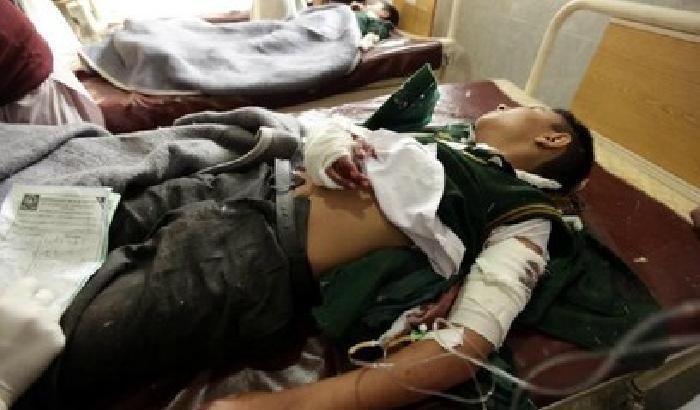 Bambini pakistani feriti