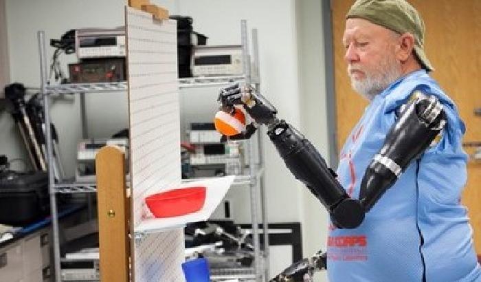 Le protesi robot che si controllano col pensiero