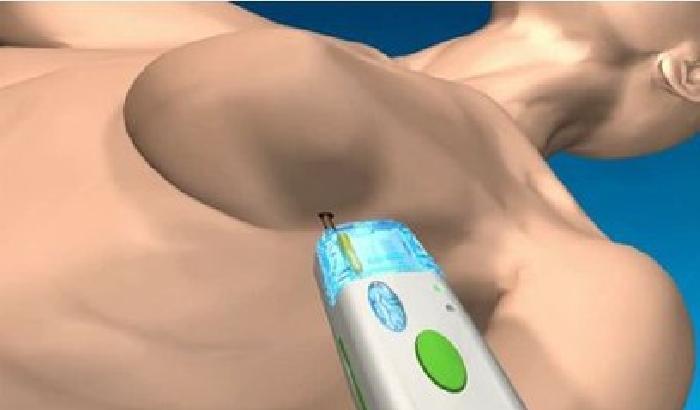 01189F-NEWS_145513 Un esame del sangue ci dirà se abbiamo un tumore