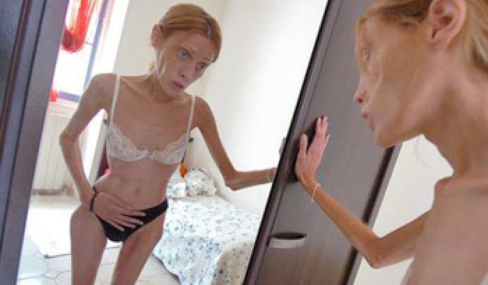 012051-NEWS_149396 Una legge per combattere l'anoressia