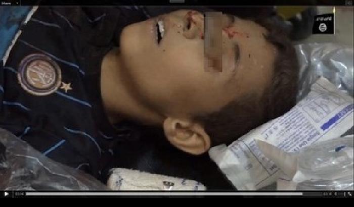 Irak: il bambino tifoso dell'Inter ferito dalle bombe americane