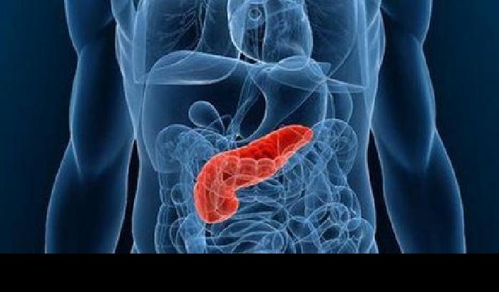 012D19-NEWS_156021 Cancro al pancreas? Si scopre con test delle urine