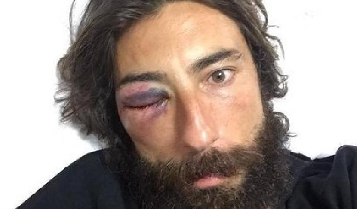 Brumotti: la mia carriera è a rischio, denuncio gli aggressori