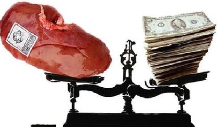 Kosovo: traffico d’organi, Uck alla sbarra