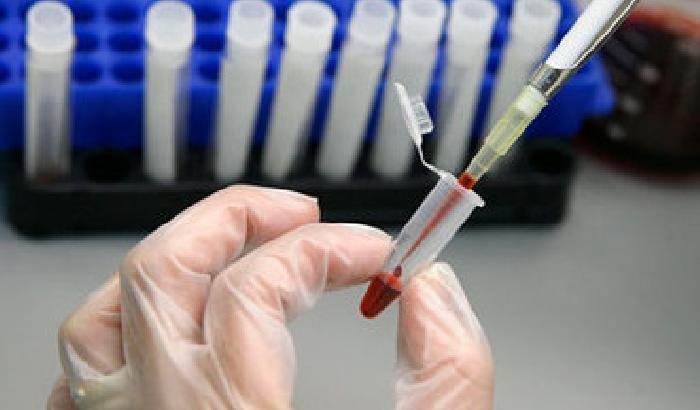 Arriva il test Hiv fai da te