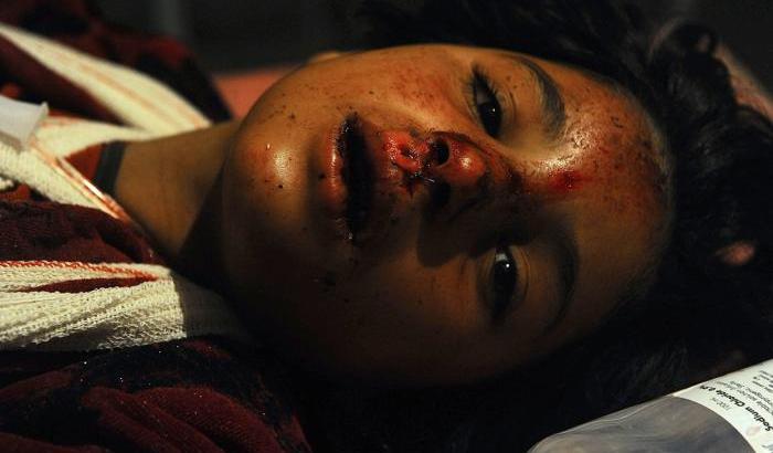 Un bambino ferito in Afghanistan