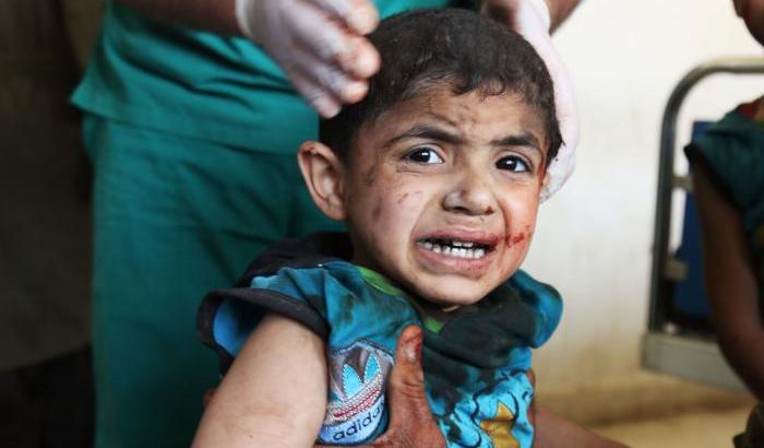 Un bambino ferito nei bombardamenti