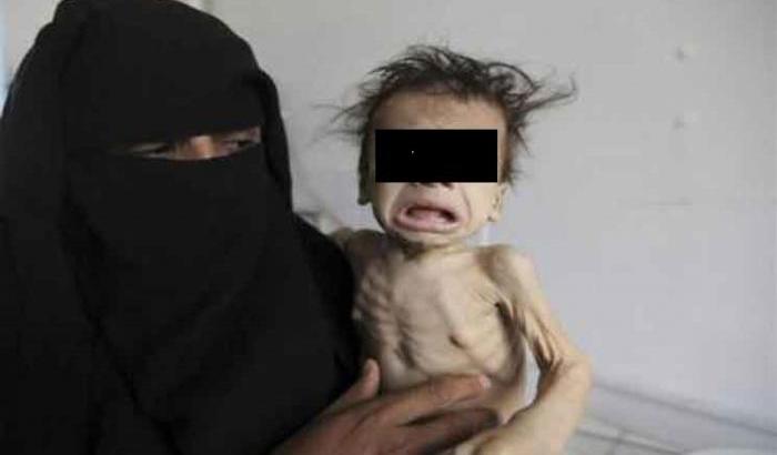 033015-un-bambino-yemenita Un bambino yemenita