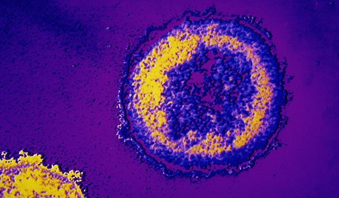 Virus dell'Hiv al microscopio