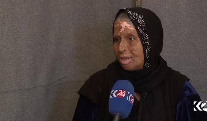 Muntaha, la donna ferita dall'Isis