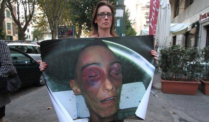 Ilaria Cucchi mostra come è stato ridotto il fratello Stefano