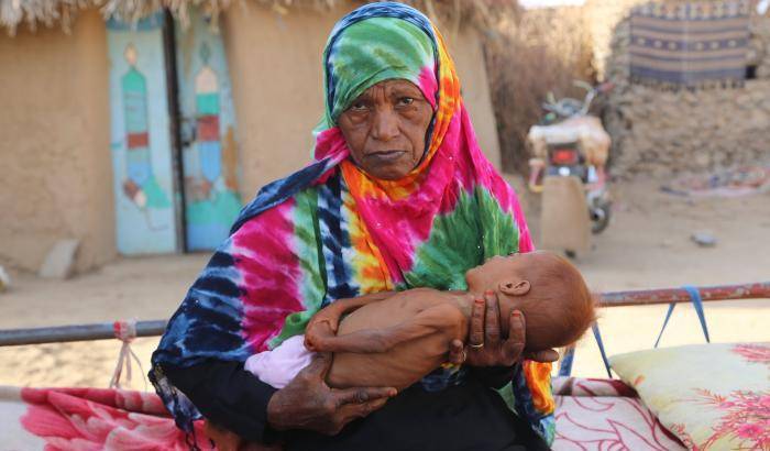 0348CA-madre-e-figlio-soffrono-la-fame-nello-yemen Madre e figlio soffrono la fame nello Yemen