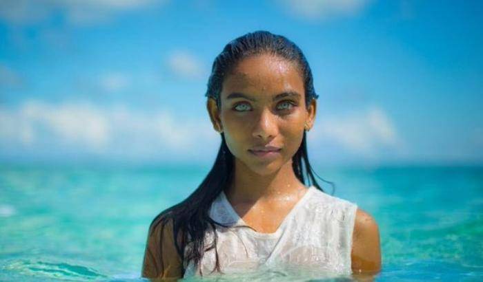 Muore a 21 anni Raudha: la ragazza con gli occhi color dell'acqua