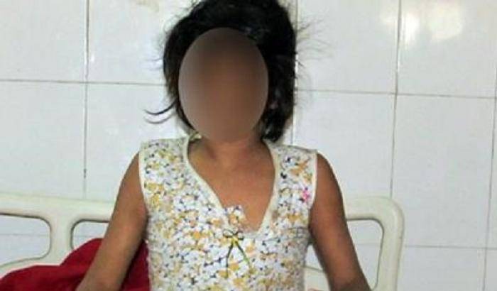 La bambina ritrovata in India che ha vissuto con un branco di scimmie