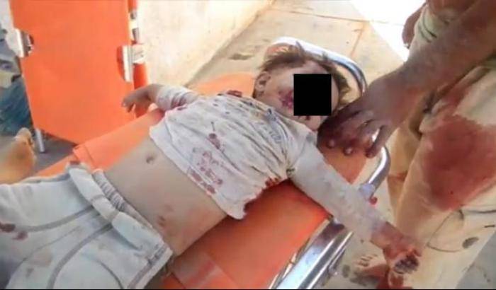 Un bambino morto in un bombardamento