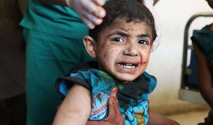 03567F-la-strage-dei-bambini-siriani-immagine-di-repertorio La strage dei bambini siriani- immagine di repertorio