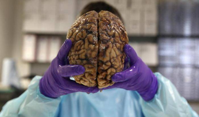 Soffri di insonnia? Attento, il cervello può iniziare a "mangiare" se stesso