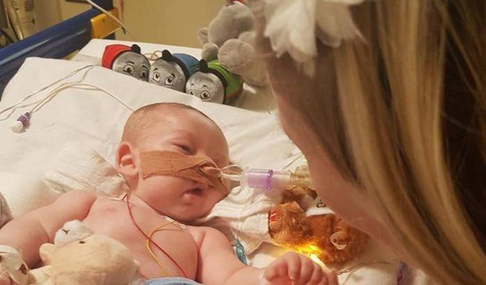 00049D23-charlie-gard Charlie Gard