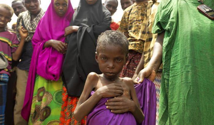 Abshivay, l'adolescente somalo rimasto bambino per colpa della fame