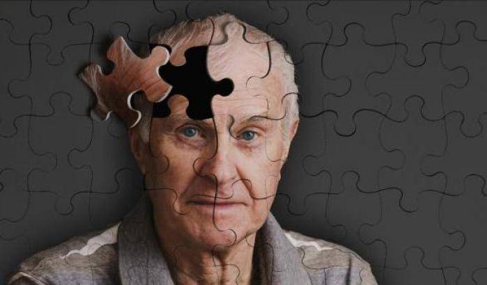 La studio: in età avanzata l'Alzheimer provoca meno mutazione genetiche