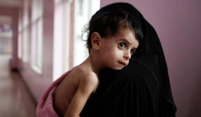 L'Onu chiede ai sauditi di rimuovere il blocco contro lo Yemen: è catastrofe umanitaria
