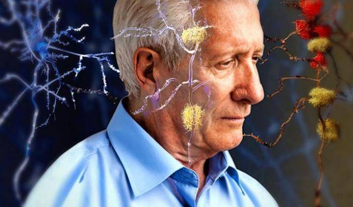 Alzheimer, un gps per rintracciare gli anziani che si perdono