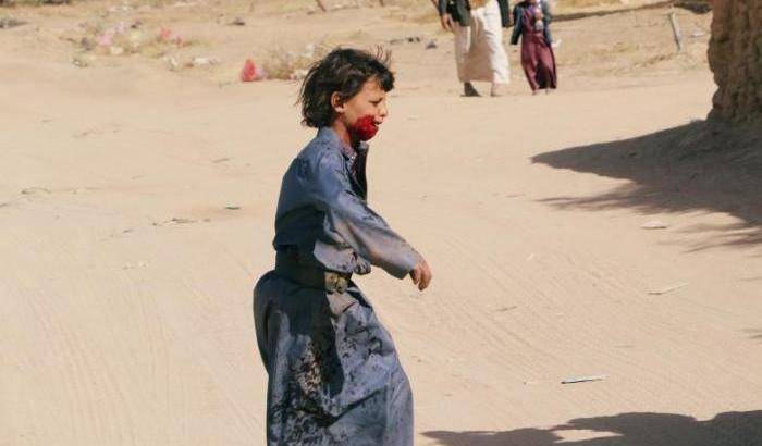 Piange, ferito dalla scheggia di una bomba: a chi interessa la vita di un bambino dello Yemen?