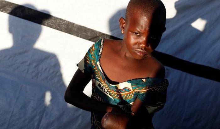 0004DE59-una-bambina-mutilata-nella-repubblica-democratica-del-congo Una bambina mutilata nella repubblica democratica del Congo