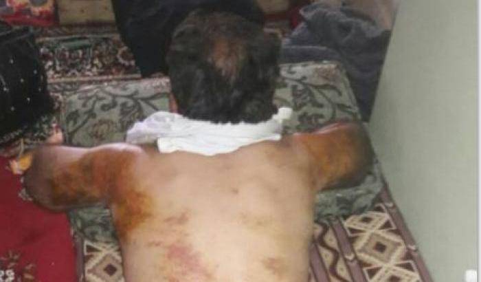 Continuano le violenze ad Afrin: civili curdi rapiti e torturati dalle milizie filo-Erdogan