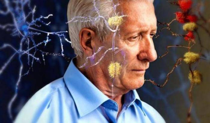 L'abuso di alcol può far scatenare l'Alzheimer