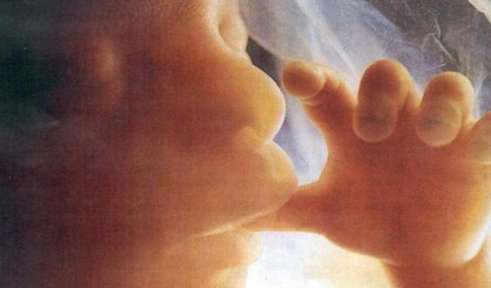 Spina bifida, intervento record al Policlinico di Milano: operati due feti in utero