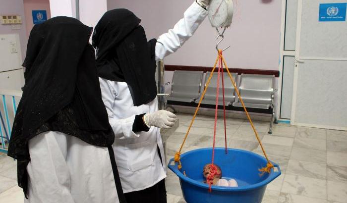 0004F801-bambini-malnutriti-nello-yemen Bambini malnutriti nello Yemen