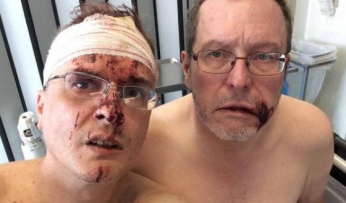 Il fumettista Padovani e il marito pestati a sangue in Belgio: "sporchi gay"