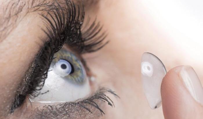 Una donna scopre di aver vissuto 28 anni con la lente incastrata nellʼocchio