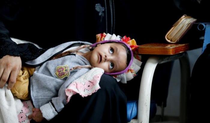 Guerra, colera e anche il cancro: nessuna pietà per la bimba yemenita