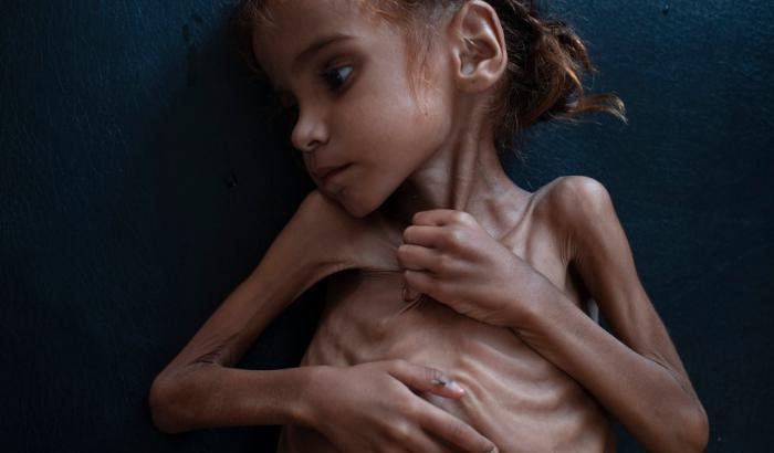 Amal non c'è più: è morta di fame a 7 anni in un campo profughi in Yemen