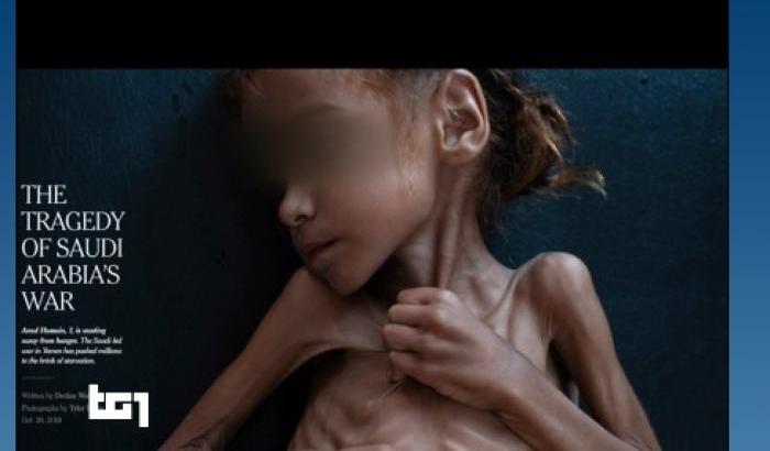 L'ipocrisia del Tg1 che censura gli occhi di Amal, morta a 7 anni di fame e indifferenza
