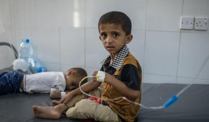 Bambini malnutriti in Yemen