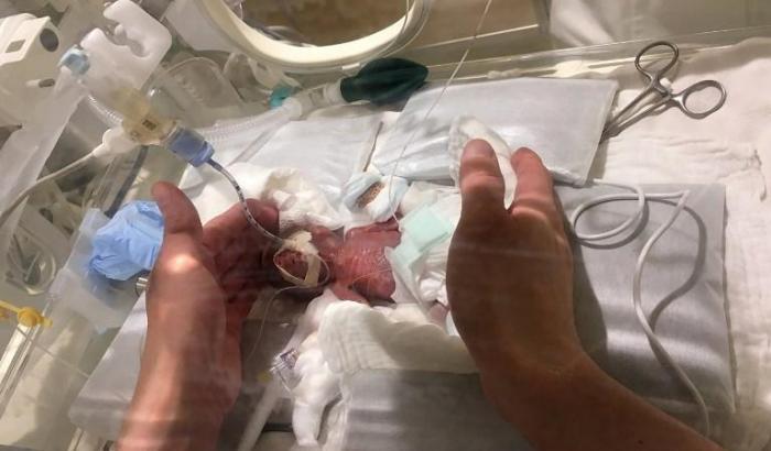 Il bimbo più piccolo del mondo torna a casa: alla nascita pesava 268 grammi