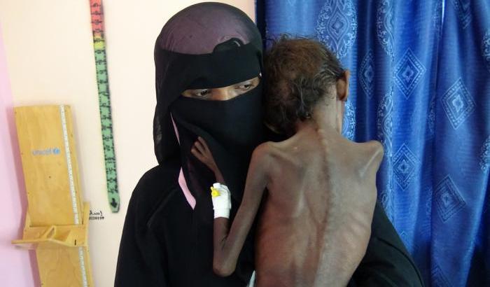 Yemen, aiuti dimezzati. La vergogna del mondo nel rapporto di Oxfam